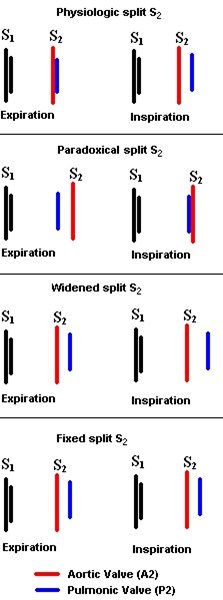 S2SpliitingComparison