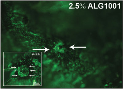 Study performed by Peter Campochiaro, MD, at Wilmer Eye Institute at Johns Hopkins University in a well-established laser-induced mouse model for choroidal neovascularization showed a 43% reduction in the area of neovascularization with ALG-1001 (n = 10) vs. vehicle (n = 9) with statistical significance (P = 0.18).