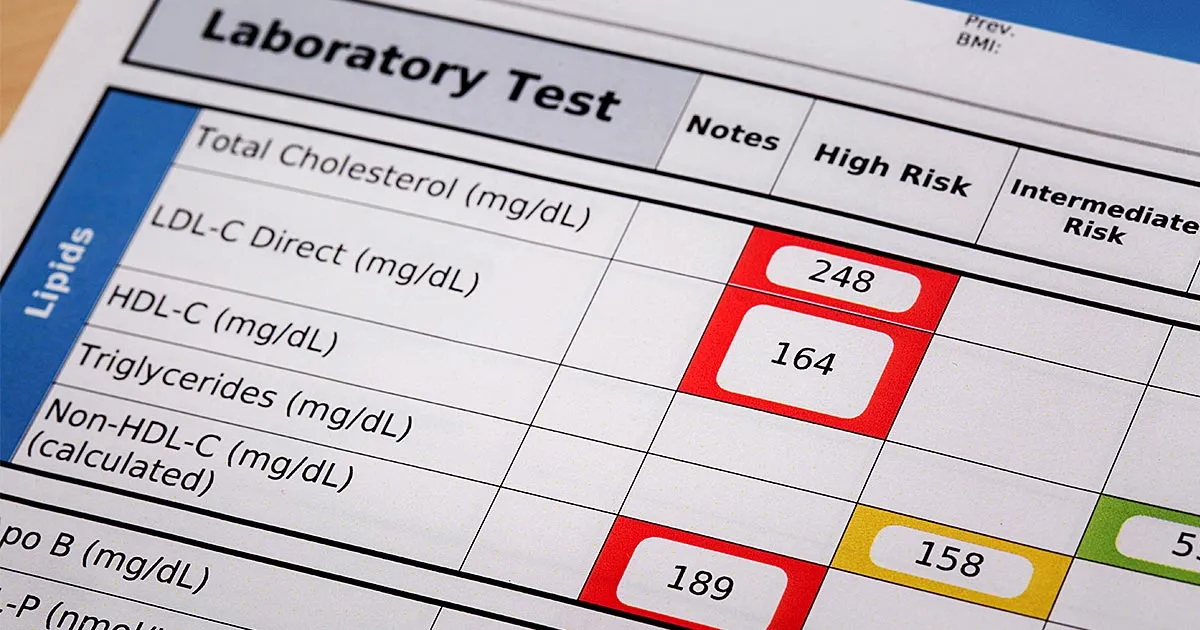 Lipid Management