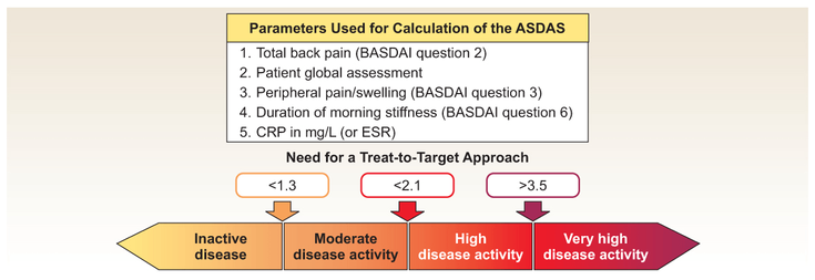 Figure 12-4: ASDAS: Ankylosing Spondylitis Disease Activity Score. Clinically important improvement is defined as ∆ ASDAS  ≥1.1 and major improvement  is defined as ∆ ASDAS ≥2.0. ASDAS app is available from <a href=