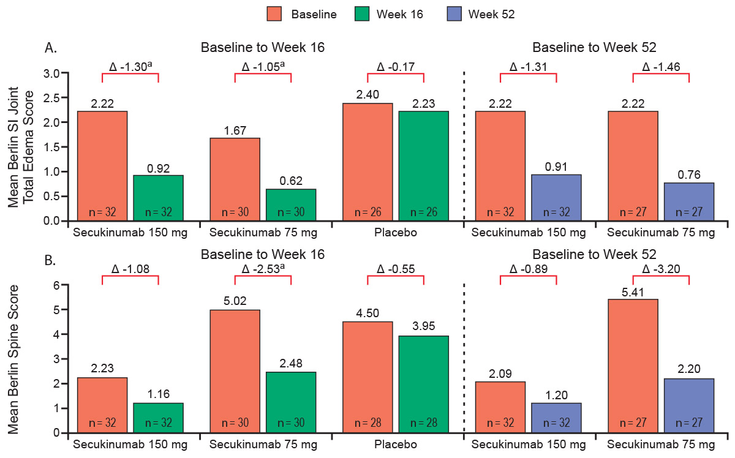 Figure 16-11: MEASURE 1: Summary of Berlin SI Joint Bone Marrow Edema and Berlin Spine Scores on Treatment With Secukinumab. Key: Mean change in Berlin SI joint total bone marrow edema (BME) score (A) and Berlin Spine Score (B) from baseline to weeks 16 and 52 (data from a subset of anti-TNF–naïve patients who had MRIs performed. Non-parametric ANCOVA model was used to analyze the change from baseline to week 16 in inflammation with treatment regimen as a factor and weight and baseline inflammation score as covariates. Each secukinumab regimen was compared with the placebo regimen via pairwise comparisons. Observed data presented at week 52. Δ Mean change from baseline to weeks 16 or 52, respectively. a) P <0.05 vs placebo. Source: Modified from Braun J, et al. Expert Opin Biol Ther. 2016;16(5):711-722.