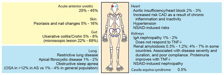 Figure 7-1: Extra-articular Manifestations/Comorbidities. Source: Khan MA. In: Hochberg M, et al, eds. Rheumatology. 3rd ed. Edinburgh, Scotland: Mosby; 2003:1161-1170; Lautermann D, Braun J. Clin Exp Rheum. 2002;6(suppl 28):S11-S15; Smale S, et al. Arthritis Rheum. 2001;44(12):2728-2736; Rodrigues CE, et al. Rev Bras Rheumatol. 2012;52(3):379-383; Solak O, et al. Rheumatology (Oxford). 2009;48(4):433-435; El Maghraoui A. Eur J Intern Med. 2011;22(6):554-560; Jacquet A, et al. Nephrol Dial Transplant. 2009;24(11):3540-3542; Ben Taarit C, et al. Rev Med Interne. 2005;26(12):966-969.