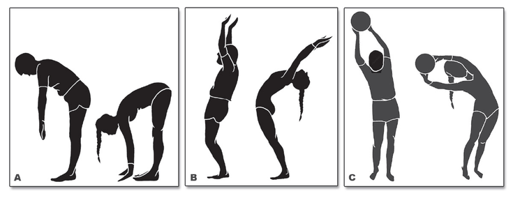 Figure 8-2: Loss of Full Flexion, Hyperextension, and Lateral Flexion. Most patients with advanced AS will have markedly decreased spinal mobility on forward (A), hyperextension (B), and lateral flexion (C) as shown in this drawing of a patient and a healthy young female. Source: Provided with permission by Dr. Heinz Baumberger.