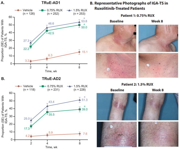 Figure 7-3: TRuE-AD1/2: IGA-TS at Weeks 2, 4, and 8. IGA-TS, Investigators Global Assessment treatment success; RUX ruxolitinib cream. <sup>a</sup> P<0.0001. Source: Adapted from Papp K, et al. J Am Acad Dermatol. 2021;85(4):863-872 [Supple­mentary Appendix].