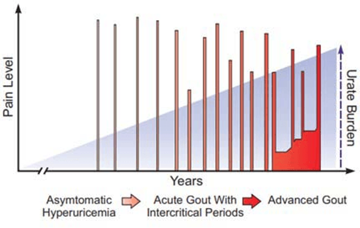 Figure 3-1: Clinical Stages of Gout