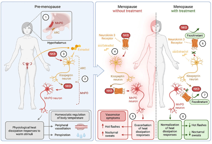 Figure 3-4: Fezolinetant Mechanism of Action. 1-2: In the hypothalamus, heat dissipation mechanisms are controlled by the kisspeptin neurons (in the arcuate nucleus [ARC]) and more proximally by neurons in the median preoptic nucleus (MnPO), which act on downstream neurons in the autonomic nervous system to induce peripheral vasodilation and perspiration. 3: Neurokinin B (NKB) stimulates kisspeptin neurons, while estradiol inhibits their activity, leading to a normal balance during the premenopause stages of a woman’s reproductive life. 4: With the drop in estradiol levels during menopause, the effects of neurokinin 3 predominate, leading to more kisspeptin and MnPO neuron activation. 5: Heat dissipation responses are exacerbated, leading to more HFs and night sweats. 6-7: Fezolinetant blocks the NK3 receptor, preventing its interaction with NKB both on the kisspeptin and the MnPO neurons. 8: This normalizes the heat dissipation responses, leading to fewer HFs and night sweats. Source: Adapted from: González-García I, López M. Fezolinetant for menopausal hot flashes and night sweats. Trends Pharmacol Sci. 2023;44(9):635-636.