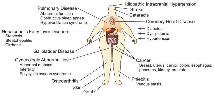 Figure 3-1: Comorbidities Associated with Obesity