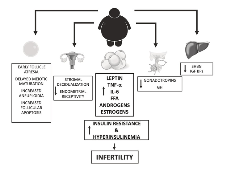 Figure 11-8: Mechanisms Linking Obesity With Infertility. Key: TNF-α, tumor necrosis factor-α; IL-6, interleukin-6; FFA, free fatty acid; GH, growth hormone; SHBG, sex hormone binding globulin; IGFBPs, insulin-like growth factor-binding proteins. Source: <em>Adapted from Gambineri A, et al. Int J Obes Suppl. 2019;9(1):65-72. </em>