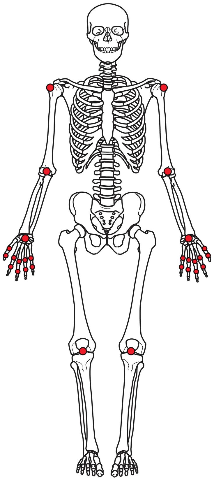 Figure 5-1: 28-joint Count