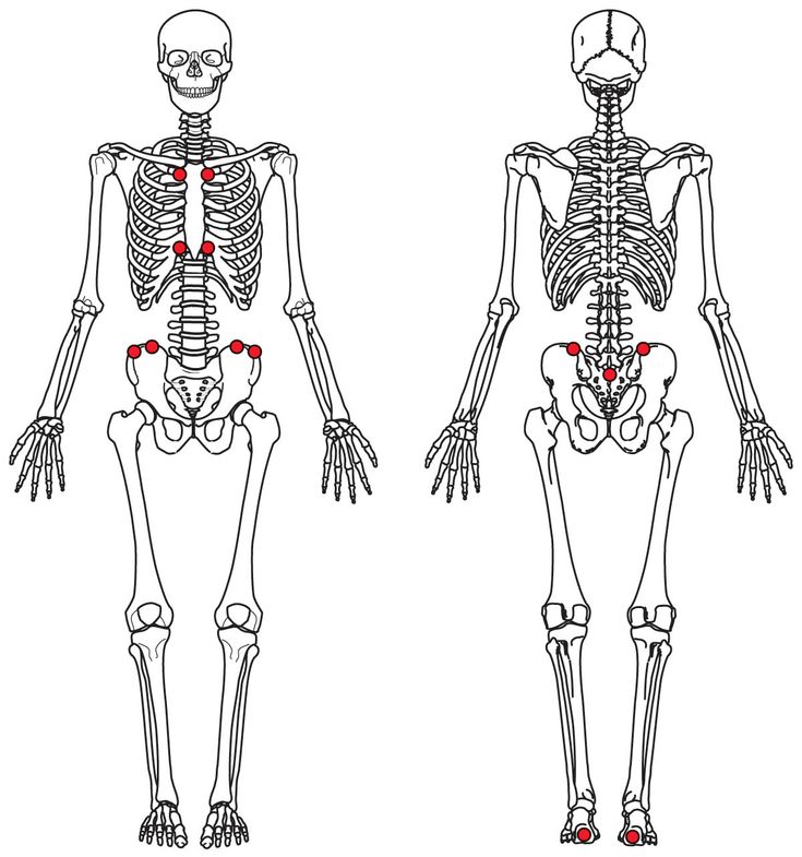 Figure 5-4: Maastricht Ankylosing Spondylitis Entheses Score (MASES)