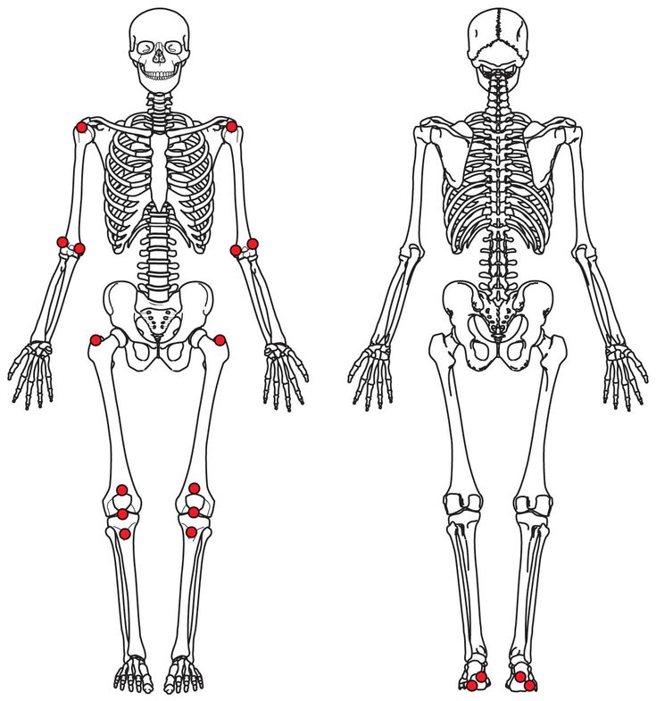 Figure 5-4: Spondyloarthritis Research Consortium of Canada Enthesitis Index (SPARCC)