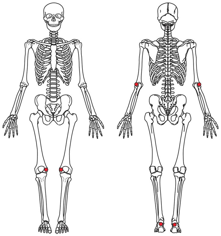 Figure 5-6: Leeds Enthesitis Index (LEI)