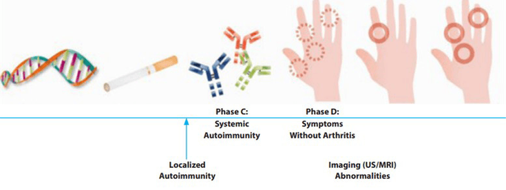 Figure 19-1: Phases of RA Development. Source: Adapted from Mankia K, et al. <em>Arthritis Rheumatol</em>. 2016;68(4):779-788.