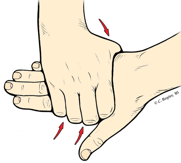 Figure 6-5: MCP Squeeze Test