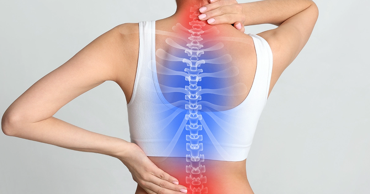 Ankylosing Spondylitis