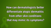 VIDEO: Differentiating atopic dermatitis from other skin conditions