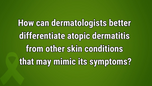 VIDEO: Differentiating atopic dermatitis from other skin conditions