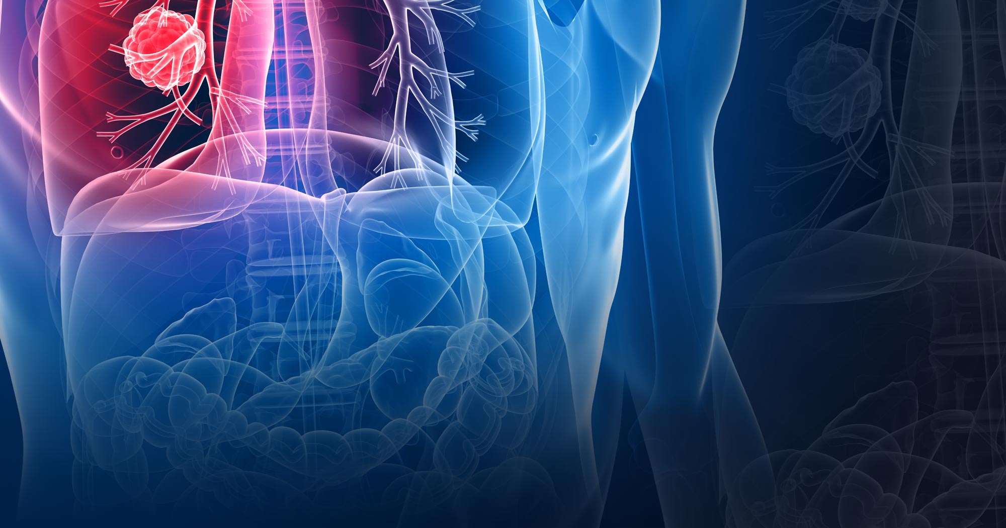 Abstract Lung Cancer Image