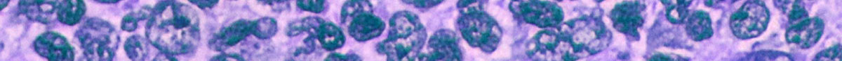 Lymphoma banner image