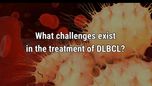 VIDEO: Treatment challenges in DLBCL care