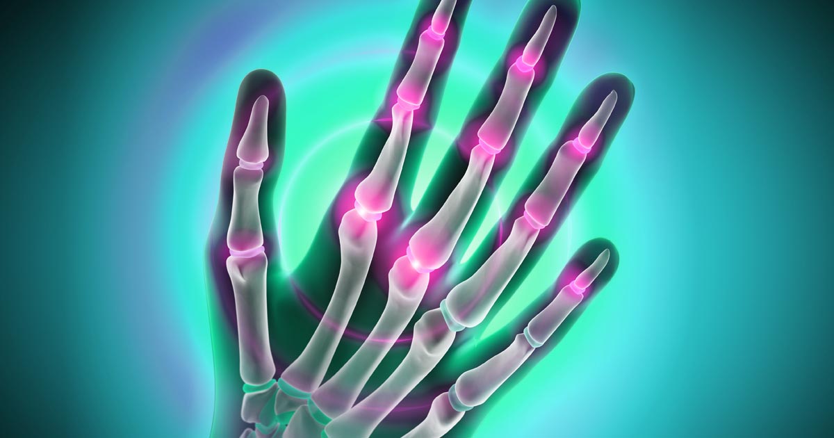 an x-ray like image of a hand over a blue background with some neon pink to highlight disease