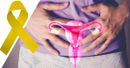 VIDEO: Reviewing available treatment options for endometriosis