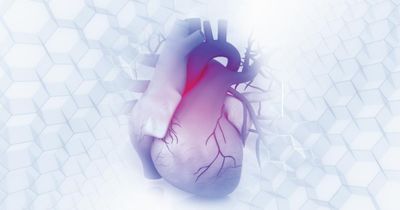 Cardiovascular factors, including hypertension, associated with risk for severe stroke  