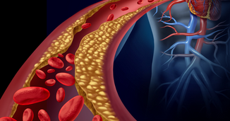 Best Practices in the Diagnosis and Management of Homozygous Familial Hypercholesterolemia