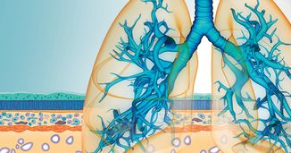 Understanding the Changing Treatment Landscape of Severe Asthma