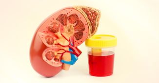 Ace the Case: A 22-Year-Old Man With Hematuria