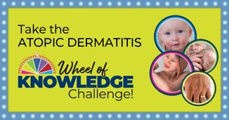 Moderate to Severe Atopic Dermatitis: When to Treat Versus When to Refer – A Wheel of Knowledge! Challenge