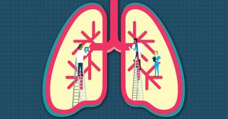 Pulmonary Arterial Hypertension: Stepped, Novel, and Multidisciplinary Approaches to Management