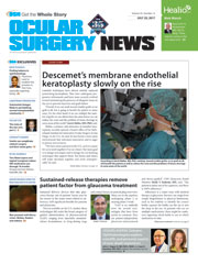 Ocular Surgery News July 25, 2017