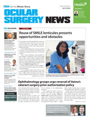 Ocular Surgery News July 25, 2021