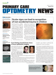 Primary Care Optometry News August 2012