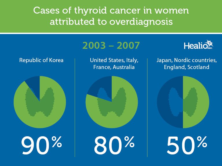 Thyroid cancer overdiagnosis Infographic