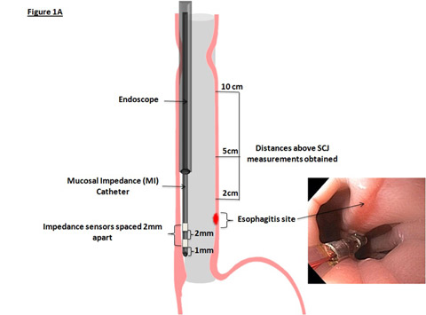 Figure 1A