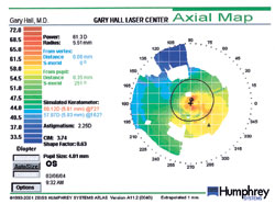 This map from 2004 indicates more symmetry and sphericity on both sides