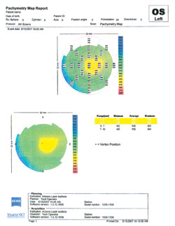 Note the center thickness as shown on the OCT