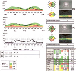  Figure 2. Stratus printout for glaucoma patient