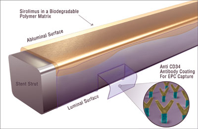 Figure. In the Combo Dual Therapy Stent, sirolimus is exclusively eluted from the abluminal surface of the stent strut.