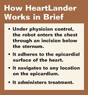 How HeartLander Works in Brief