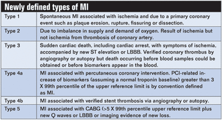 Newly defined types of MI