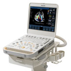 Philips CX50 CompactXtreme ultrasound system