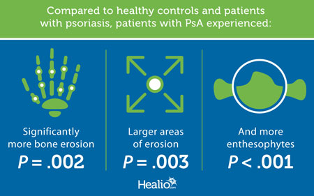 Comparing healthy controls and patients with psoriasis, patients with PsA experienced