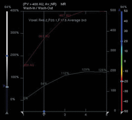 Figure 8: Kinetic curve time