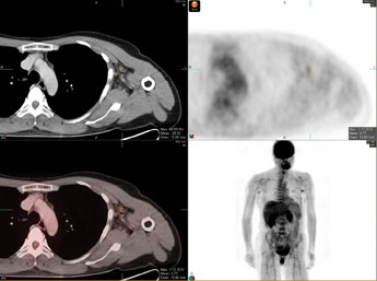 Axial PET/CT