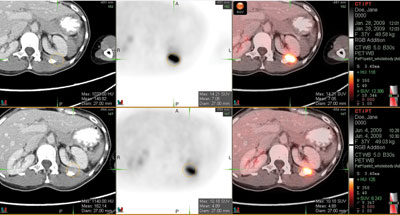 Axial PET/CT images