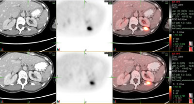 Axial PET/CT images