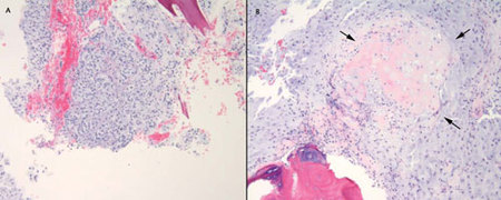 Axial postcontrast T1-weighted images with fat saturation.